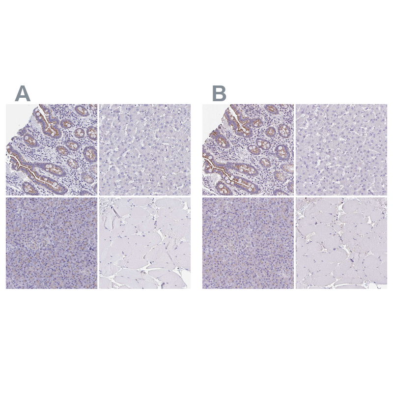 Atlas Antibodies Anti-CHMP5 Antibody