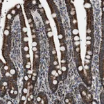 Atlas Antibodies Anti-CHN2 Antibody