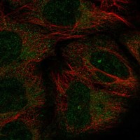 Atlas Antibodies Anti-CHODL Antibody
