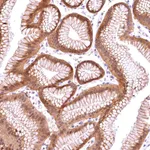 Atlas Antibodies Anti-CHORDC1 Antibody