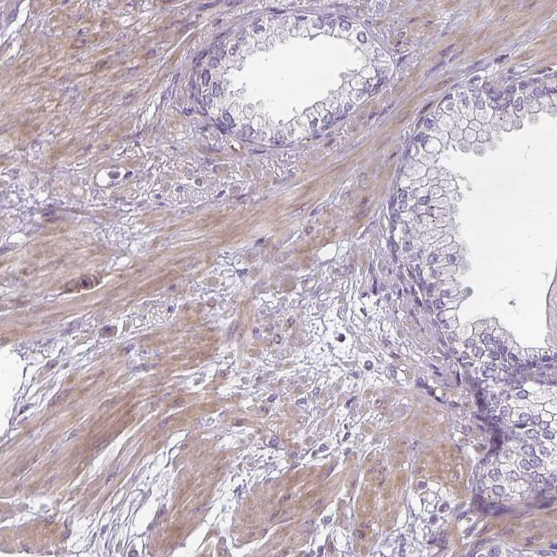 Atlas Antibodies Anti-CHRDL1 Antibody