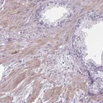 Atlas Antibodies Anti-CHRDL1 Antibody