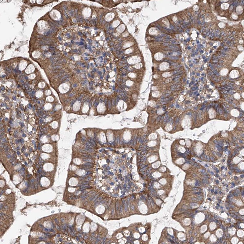 Atlas Antibodies Anti-CHPF Antibody
