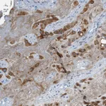 Atlas Antibodies Anti-CHPF2 Antibody
