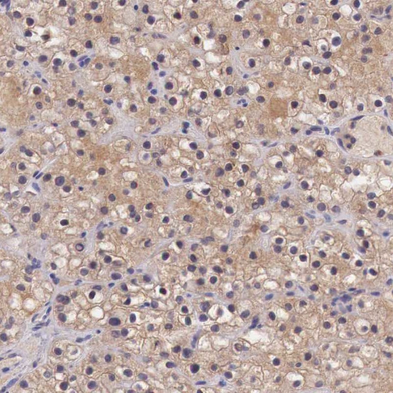 Atlas Antibodies Anti-CHRDL1 Antibody