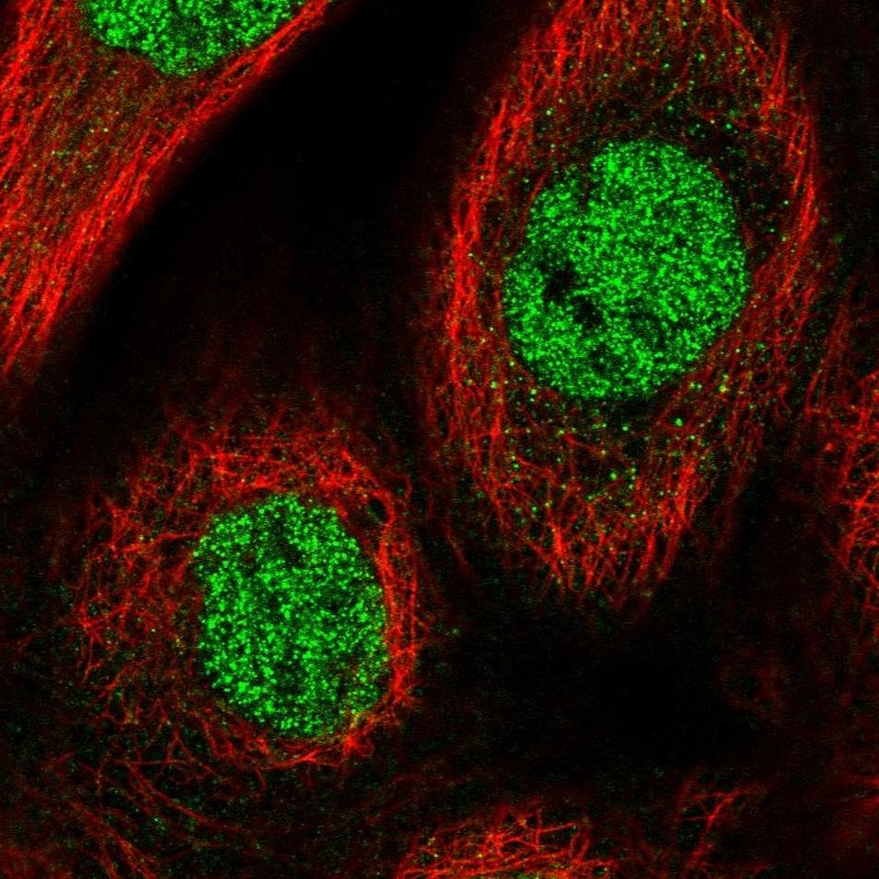 Atlas Antibodies Anti-CHRAC1 Antibody