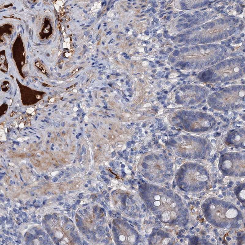 Atlas Antibodies Anti-CHRD Antibody