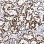 Atlas Antibodies Anti-CHRDL2 Antibody
