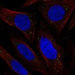 Atlas Antibodies Anti-CHRDL2 Antibody