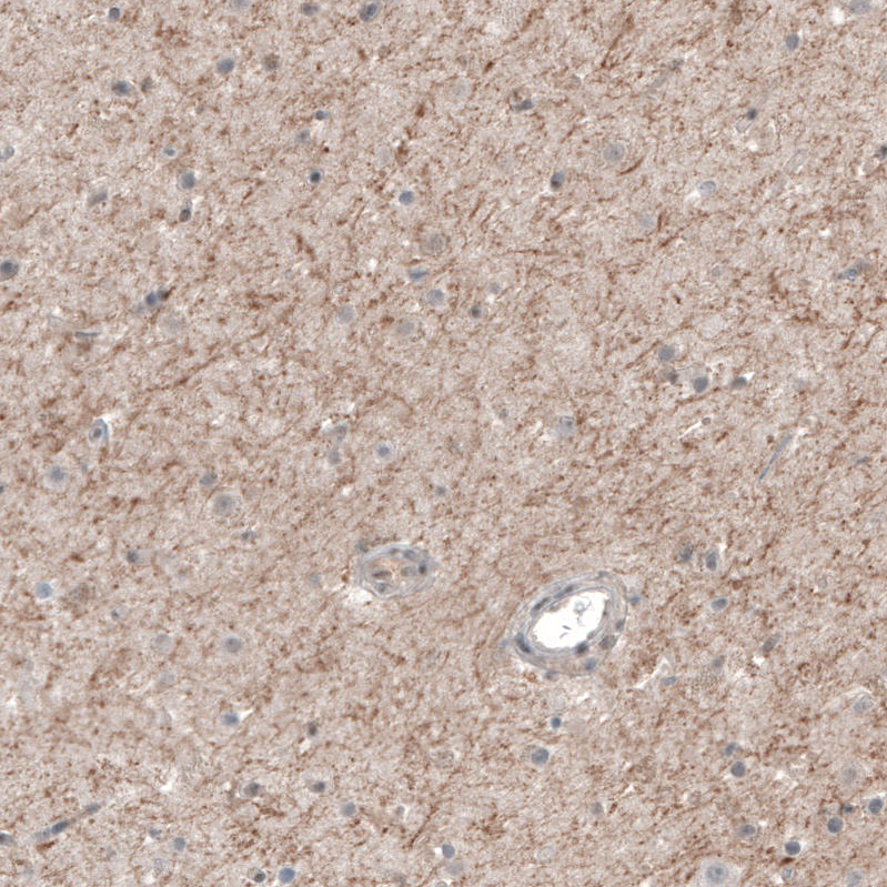 Atlas Antibodies Anti-CHRM3 Antibody