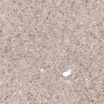 Atlas Antibodies Anti-CHRM3 Antibody