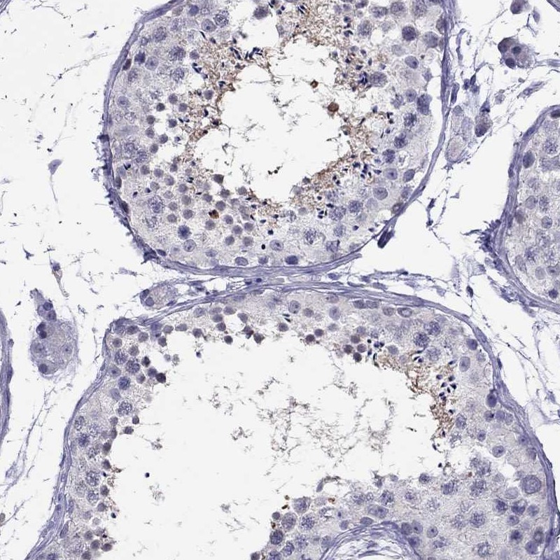Atlas Antibodies Anti-CHRNB3 Antibody