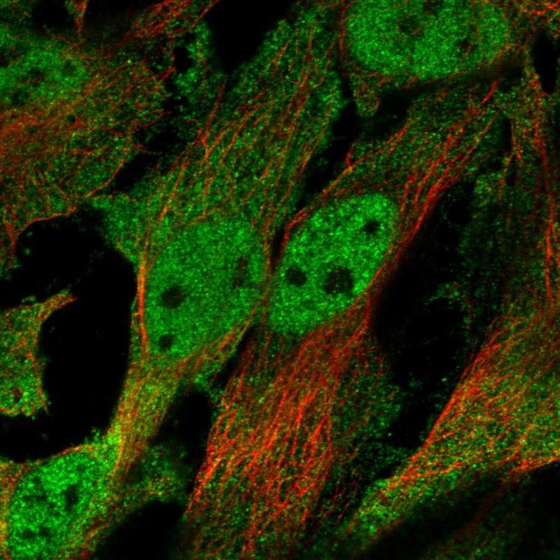 Atlas Antibodies Anti-CHRND Antibody