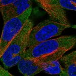 Atlas Antibodies Anti-CHRND Antibody