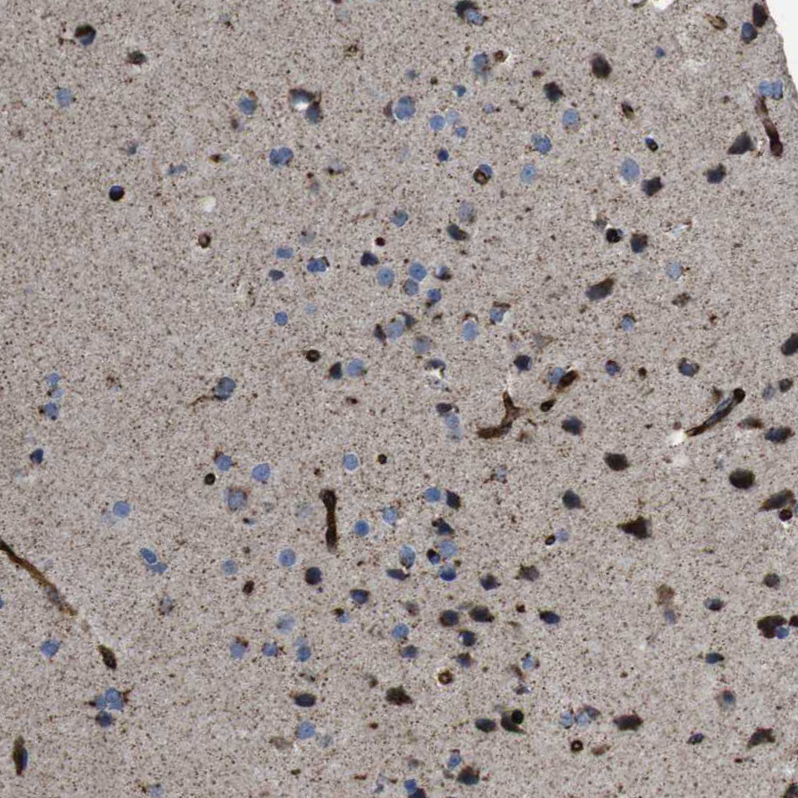 Atlas Antibodies Anti-CHST10 Antibody