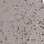 Atlas Antibodies Anti-CHST10 Antibody
