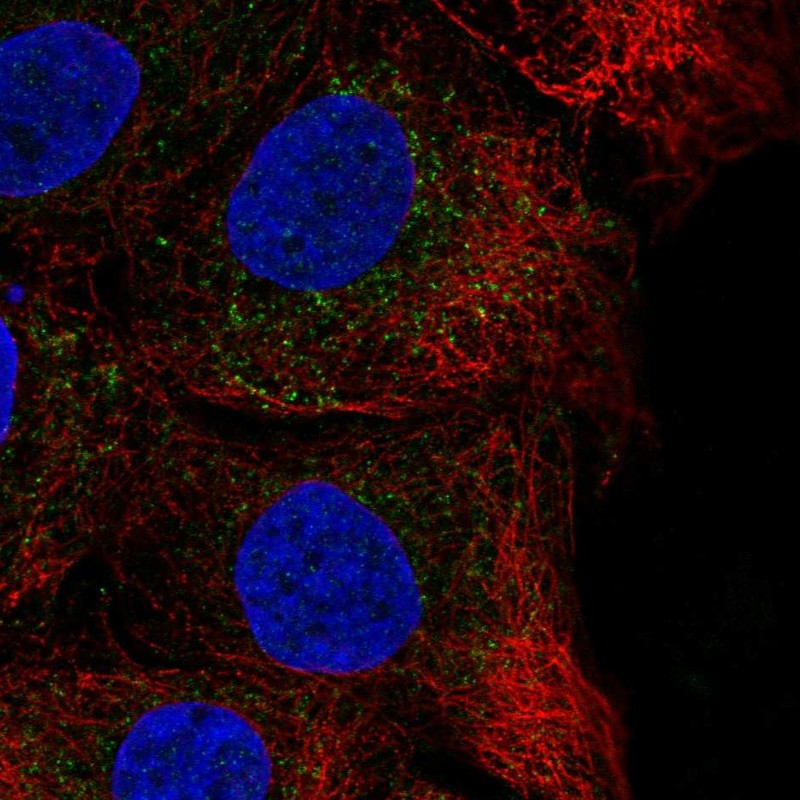 Atlas Antibodies Anti-CHST14 Antibody