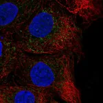Atlas Antibodies Anti-CHST14 Antibody