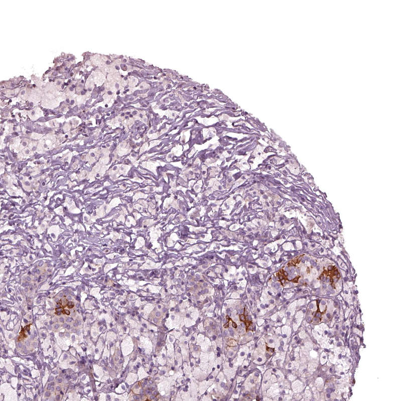 Atlas Antibodies Anti-CHST14 Antibody