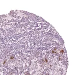 Atlas Antibodies Anti-CHST14 Antibody