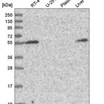 Atlas Antibodies Anti-CHST3 Antibody