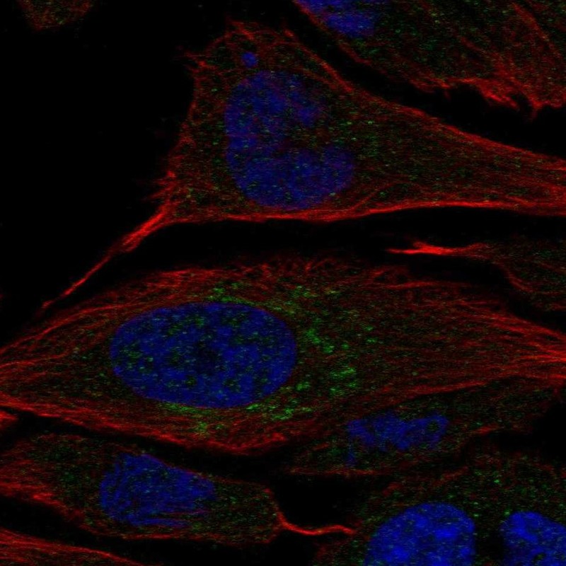 Atlas Antibodies Anti-CHST2 Antibody