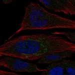 Atlas Antibodies Anti-CHST2 Antibody