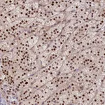 Atlas Antibodies Anti-CHST12 Antibody