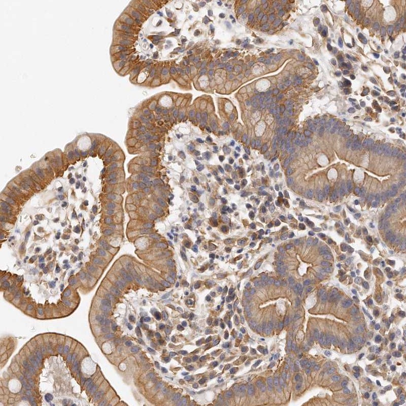 Atlas Antibodies Anti-CHST7 Antibody
