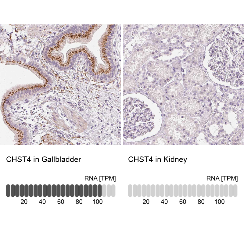 Atlas Antibodies Anti-CHST4 Antibody