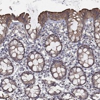 Atlas Antibodies Anti-CHST5 Antibody
