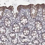 Atlas Antibodies Anti-CHST5 Antibody