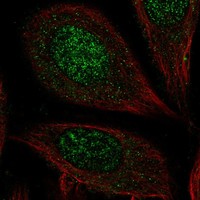 Atlas Antibodies Anti-CHST7 Antibody