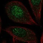 Atlas Antibodies Anti-CHST7 Antibody