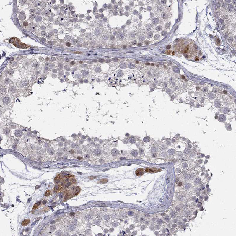 Atlas Antibodies Anti-CHST8 Antibody