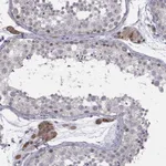 Atlas Antibodies Anti-CHST8 Antibody