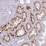 Atlas Antibodies Anti-CHSY1 Antibody