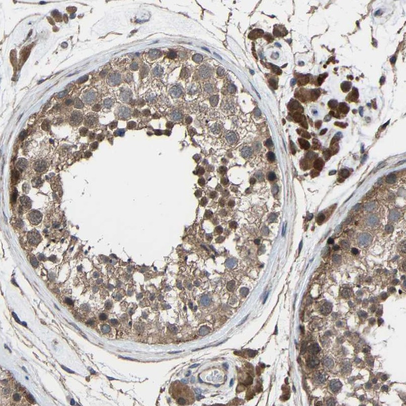 Atlas Antibodies Anti-CHST9 Antibody