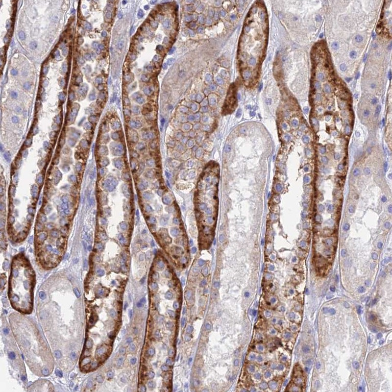 Atlas Antibodies Anti-CHSY3 Antibody