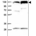 Atlas Antibodies Anti-CHTF18 Antibody