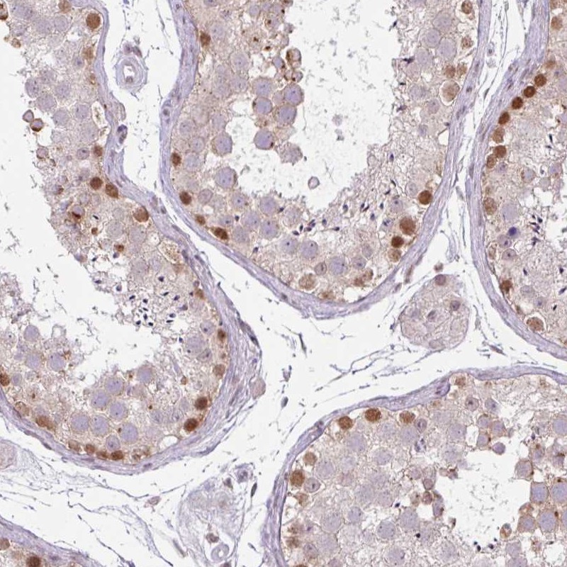 Atlas Antibodies Anti-CHTF8 Antibody