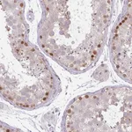 Atlas Antibodies Anti-CHTF8 Antibody