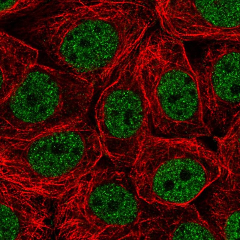 Atlas Antibodies Anti-CHTF18 Antibody