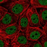 Atlas Antibodies Anti-CHTF18 Antibody