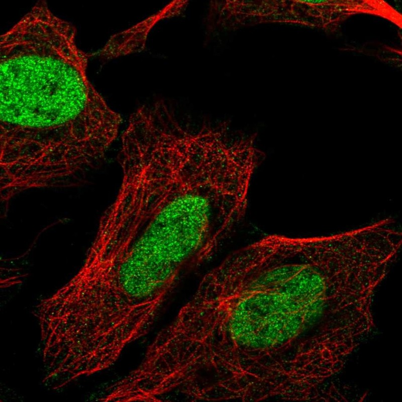 Atlas Antibodies Anti-CHTF8 Antibody