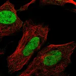 Atlas Antibodies Anti-CHTF8 Antibody