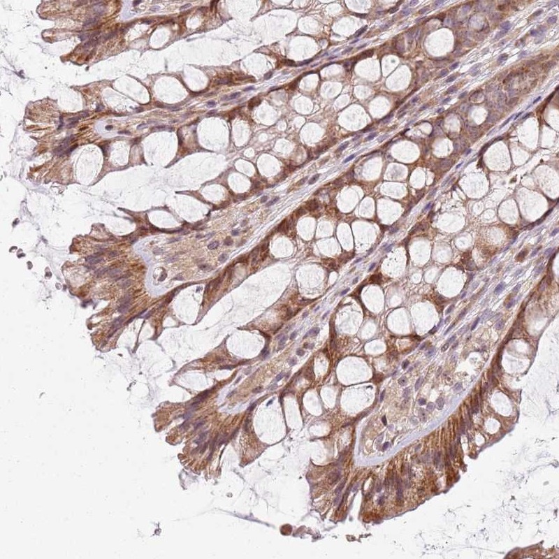 Atlas Antibodies Anti-CHURC1 Antibody