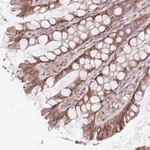 Atlas Antibodies Anti-CHURC1 Antibody
