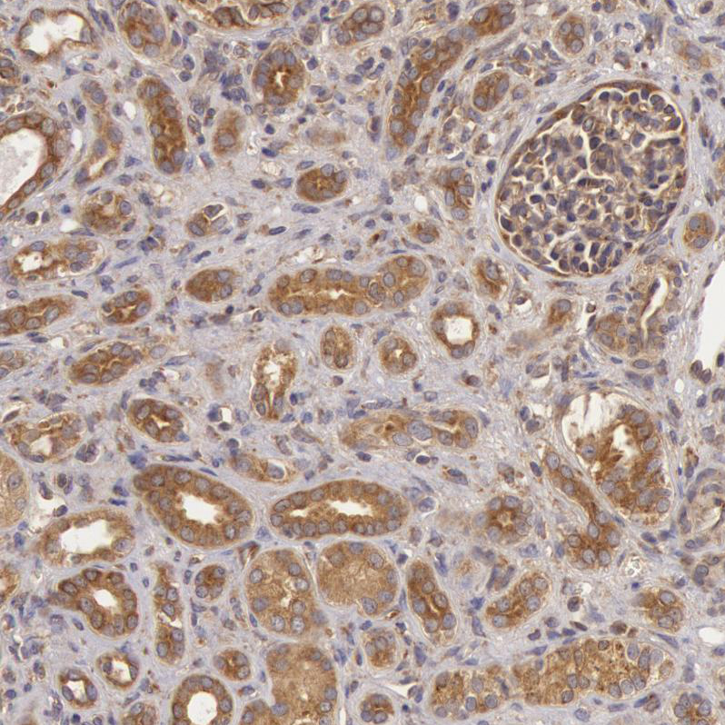 Atlas Antibodies Anti-CHUK Antibody