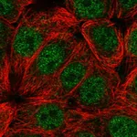 Atlas Antibodies Anti-CIART Antibody